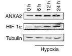 HIF1A Antibody - Figure 4
Hypoxia regulates the expression of RP11-531A24.