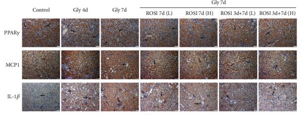 IL1 beta Antibody - Figure 2
ROSI decreased renal tubular injury, cell apoptosis, and proinflammatory response in the mouse model.