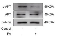 Phospho-AKT1/2/3 (Ser473) Antibody - Fig.