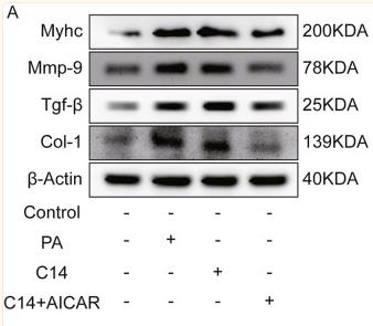 MMP9 Antibody - Fig.