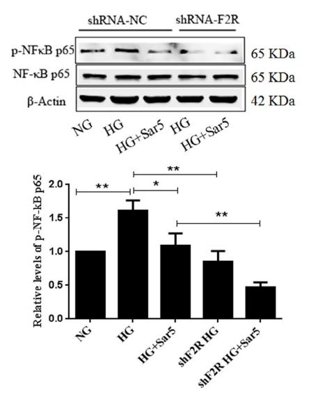 NF-kB p65 Antibody - FIGURE 9 Effects of PAR-1 knockdown on p-NF-κB p65 by western blot (a) as well as NF-κB p65 (b) and p-NF-κB p65 (c) by
immunofluorescence in SH-SY5Y cells treated with high glucose.