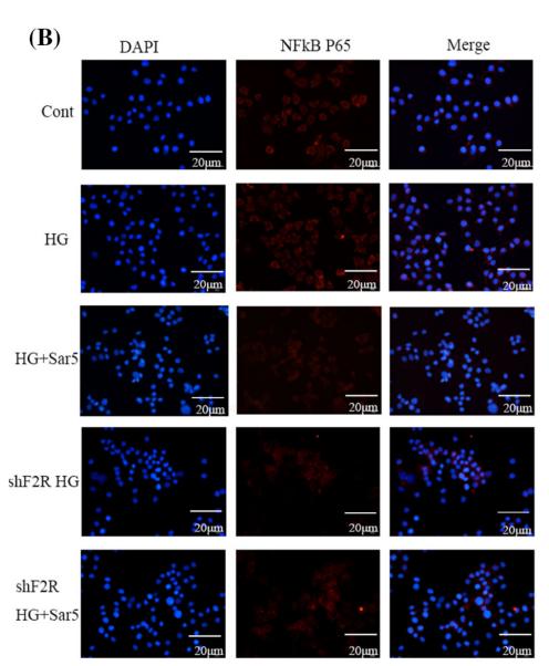 NF-kB p65 Antibody - FIGURE 9 Effects of PAR-1 knockdown on p-NF-κB p65 by western blot (a) as well as NF-κB p65 (b) and p-NF-κB p65 (c) by
immunofluorescence in SH-SY5Y cells treated with high glucose.