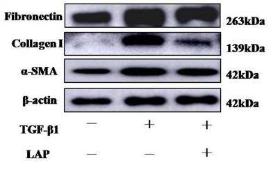 Collagen I Antibody - Figure 4
Western blot analysis of the effect of recombinant LAP on fibrosis-related proteins expression in H9C2 cells.