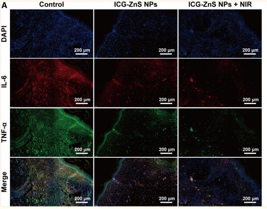 IL6 Antibody - Fig.
