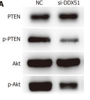 Phospho-AKT1/2/3 (Ser473) Antibody - Figure 4
Knockdown of DEAD-box helicase 51 induced inactivation of the phosphoinositide 3-kinase/AKT signaling pathway.