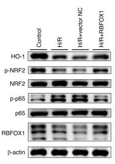 NF-kB p65 Antibody - Figure 10
RBFOX1 affects the NF-κB and NRF2/HO-1 pathway in H/R-induced HK-2 cells.