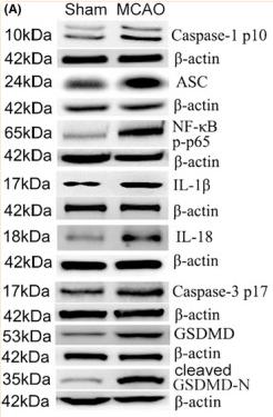 GSDMD Antibody - FIGURE 2
Cerebral ischaemia induces the expression of proinflammatory cytokines, apoptotic‐ and pyroptotic‐related proteins.