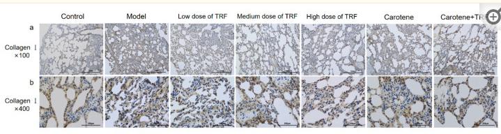 Collagen I Antibody - Figure 3
TRF and carotene ameliorated bleomycin-induced pulmonary fibrosis.