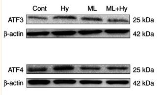 ATF4 Antibody - Figure 4.