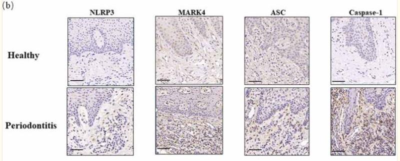 NLRP3 Antibody - Figure 1.