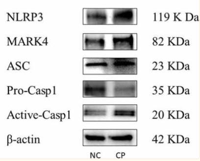 NLRP3 Antibody - Figure 1.