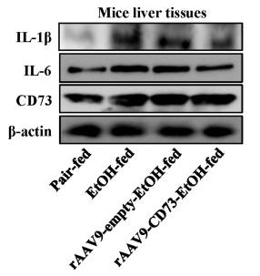 IL6 Antibody - Figure 5
rAAV9‑CD73 protected against alcohol-induced liver injury and inflammation.