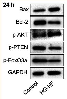 Phospho-AKT1/2/3 (Ser473) Antibody - Figure 2
Effects of high levels of glucose and fat on expression of apoptosis-related and PTEN/Akt/FOXO3a proteins in H9c2 cells.