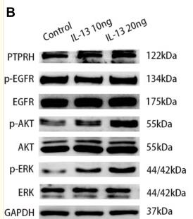 ERK1/2 Antibody - Figure 7
The expression of PTPRH was induced by cytokine IL-13 and the effect of PTPRH on EGFR, ERK1/2, and AKT in HBECs.