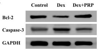 Bcl-2 Antibody - Fig.