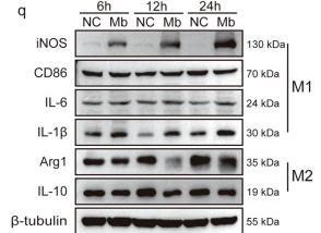 IL1 beta Antibody - Fig.