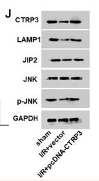 Phospho-JNK1/2/3 (Thr183+Tyr185) Antibody - Figure 7
Overexpression of CTRP3 ameliorated I/R injury.