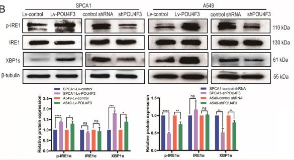 Phospho-IRE1 (Ser724) Antibody - Figure 4
POU4F3 activated the ERS pathways in LUAD cells according to WB.