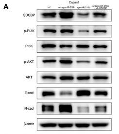 PI3K p85 alpha Antibody - Figure 5
MiR-216b modulates PC EMT through the PI3K/AKT pathway.
