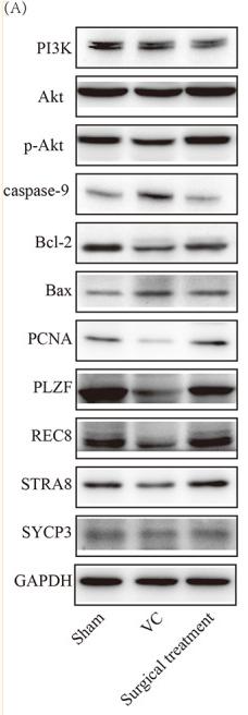 Phospho-AKT1/2/3 (Ser473) Antibody - FIGURE 13
Validation of regulated signalling pathways, spermatogenic cell apoptosis and proliferation, and meiotic spermatocytes by Western blot.