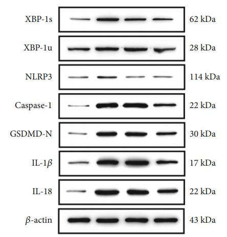 Cleaved-IL-1 beta (Asp116) Antibody - Figure 2: | CI/R activated XBP-1 slicing, neuroinflammation, and neuron pyroptosis in the rat MCAO model.