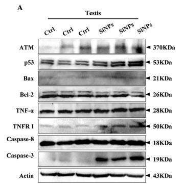 beta Actin Antibody - Fig.