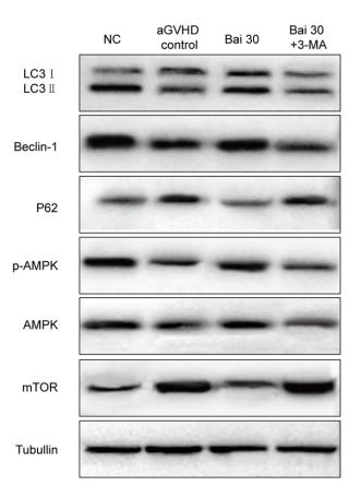 LC3A/B Antibody - Figure 2.
