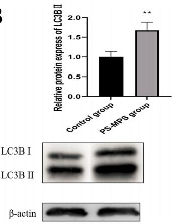 beta Actin Antibody - Fig.