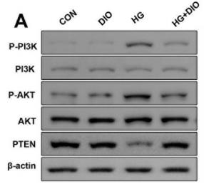 PI3K p85 alpha Antibody - Fig.