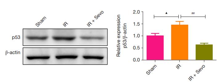 beta Actin Antibody - Figure 6 |The effect of sevoflurane on the protein expression of p53 and Nrf2 in liver tissue induced by IR.