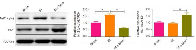 GAPDH Antibody - Figure 6 |The effect of sevoflurane on the protein expression of p53 and Nrf2 in liver tissue induced by IR.