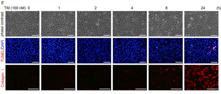 Collagen I Antibody - Fig.