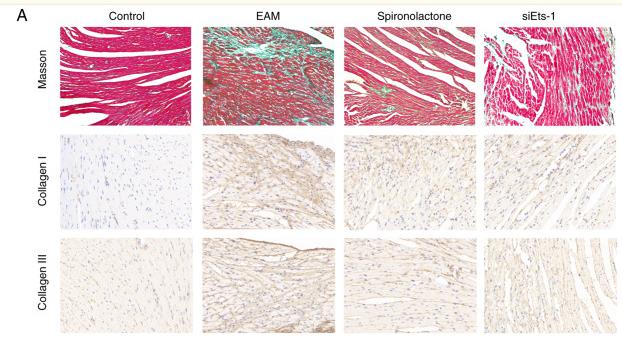 Collagen I Antibody - Figure 5
Inhibition of Ets-1 attenuate myocarditis-induced cardiac fibrosis.