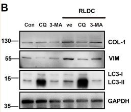 Collagen I Antibody - FIGURE 5
Inhibition of autophagy suppresses fibrotic phenotype changes in RLDC-treated BUMPT cells.