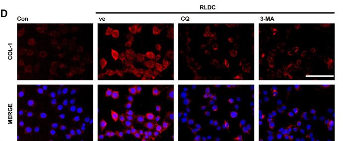 Collagen I Antibody - FIGURE 5
Inhibition of autophagy suppresses fibrotic phenotype changes in RLDC-treated BUMPT cells.