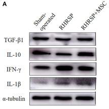 IL1 beta Antibody - Figure 9
Effects of MSCs treatment on the expression of cytokines in the hippocampus.
