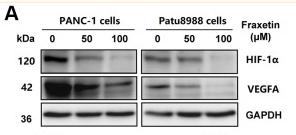 HIF1A Antibody - Figure 7
Fraxetin inhibited angiogenesis, glucose metabolism and EMT in PCCs.