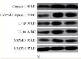 GAPDH Antibody - Figure 6
Tuina treatment influenced the expression of pyroptosis-related molecules in the hippocampi of HIE rats.
