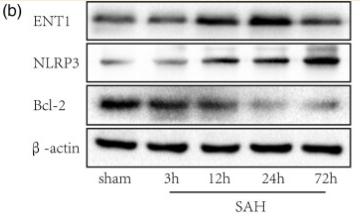 beta Actin Antibody - Fig.