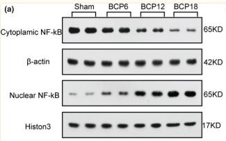 NF-kB p65 Antibody - FIGURE 7
Spinal cord nuclear factor‐kappa B (NF‐κB) translocation from the cytoplasm to the nucleus induced by bone cancer pain (BCP).