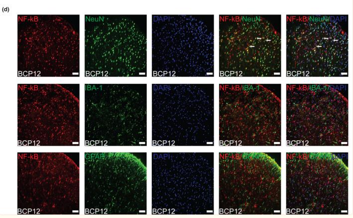 NF-kB p65 Antibody - FIGURE 7
Spinal cord nuclear factor‐kappa B (NF‐κB) translocation from the cytoplasm to the nucleus induced by bone cancer pain (BCP).