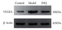 VEGFA Antibody - Figure 7
Effect of JHQ on core target proteins abundant in LX-2 cells after CuSO4 treatment.