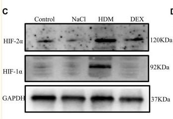 GAPDH Antibody - FIGURE 7
The expression of HIF-1α and HIF-2α in the brain was increased in the HDM group.