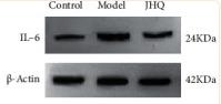 IL6 Antibody - Figure 7
Effect of JHQ on core target proteins abundant in LX-2 cells after CuSO4 treatment.