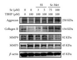 MMP9 Antibody - Figure 2
Se ameliorated TBHP-induced apoptosis and ECM degeneration of NPCs.