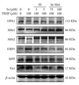 DRP1 Antibody - Figure 3
Se suppressed mitochondrial fission in TBHP-Exposed NPCs.
