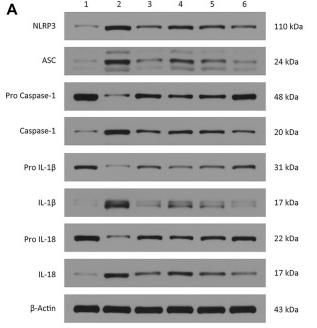 IL1 beta Antibody - FIGURE 10
Effect of TTWC on the Level of NLRP3, ASC, pro-caspase-1, caspase-1, pro-IL-1beta, IL-1beta, pro-IL-18 and IL-18 protein in the prefrontal cortex (B1-B8) (Mean ± SD, n = 3).