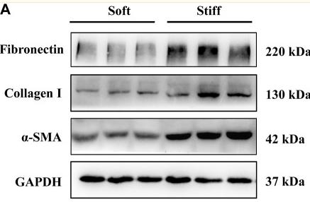 GAPDH Antibody - FIGURE 1
ECM stiffness activates MCs.