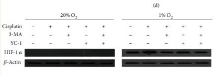 HIF1A Antibody - Figure 5
Expression of related marker proteins and genes under normoxic and hypoxic conditions by Western blotting.