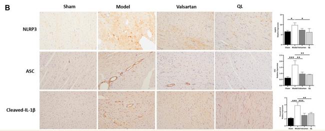 Cleaved-IL-1 beta (Asp116) Antibody - FIGURE 6
QL inhibits inflammasome generation in HF (A) Western blot analysis of NLRP3, ASC, caspase-1, and cleaved-IL-1β protein expression in the cardiac tissue.